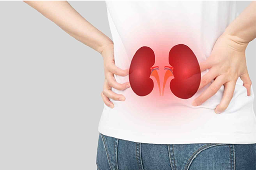 Renal (kidney) Checkup
